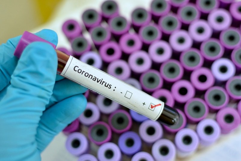 Lab Test Tube Testing Coronavirus - Test is Positive